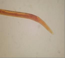 Fig. 3 Anterior end of Trichostrongylus spp. 3erd stage larve (x400)